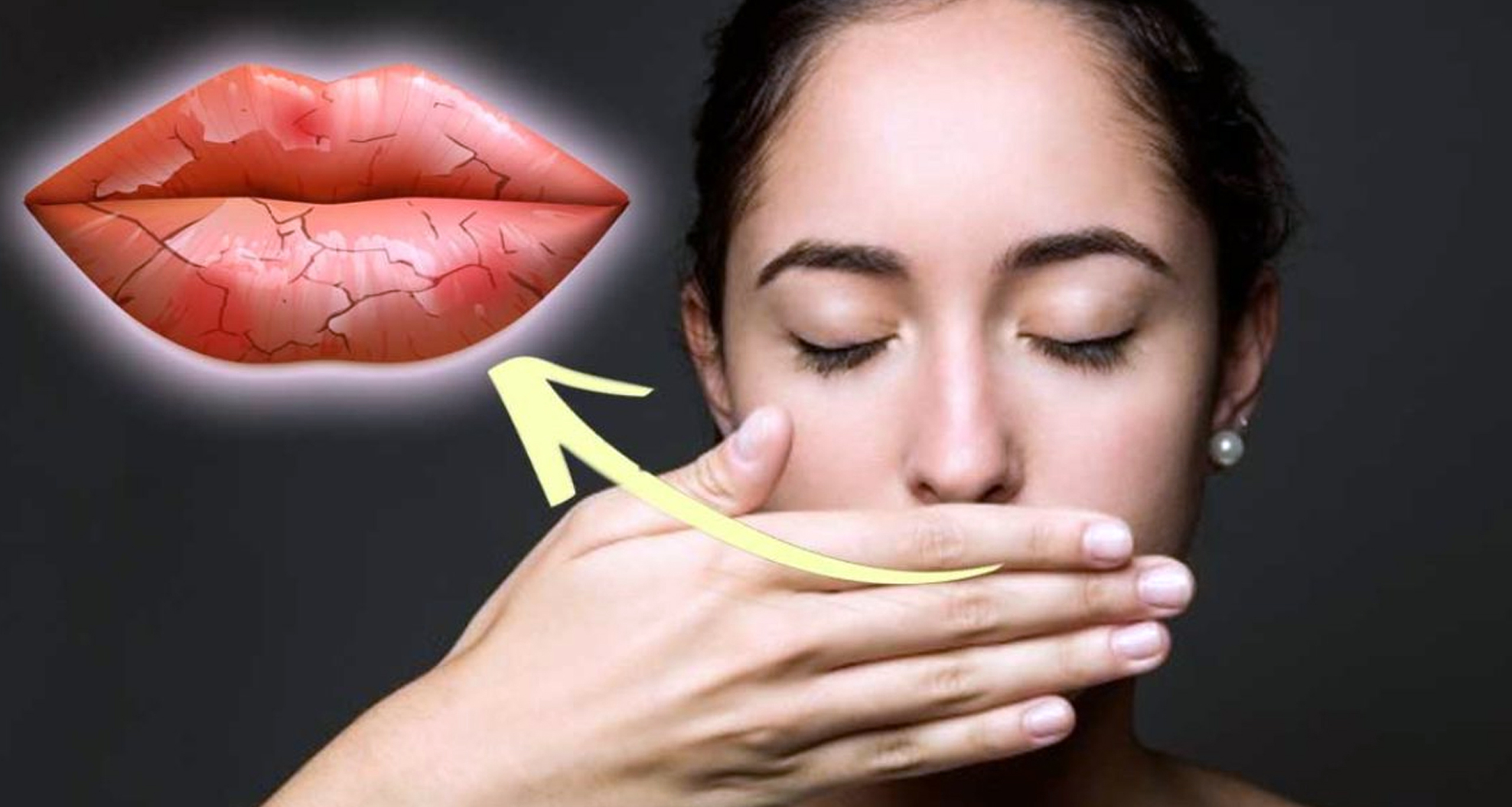 ঠোঁট ফেটে