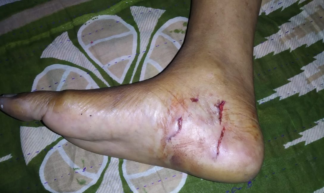 কালীগঞ্জে শিয়ালের কামড়ে নারীসহ আহত ৩