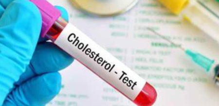 blood cholesterol