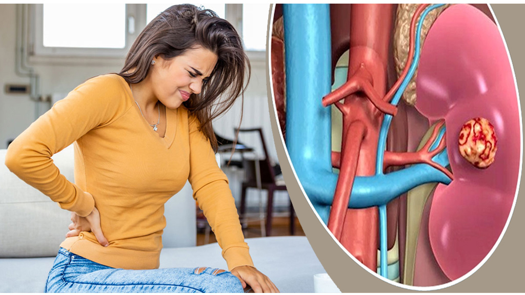 কিডনি ড্যামেজ