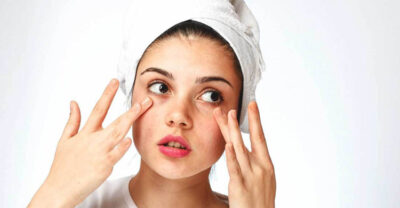 ত্বকের উজ্জ্বলতাও