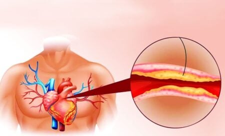 Cholesterol