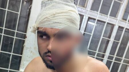 পুত্রবধূর মাদ্রাসাশিক্ষক পরকীয়া প্রেমিকের কান কামড়ে ছিঁড়ে নিলেন শ্বশুর Munshiganj