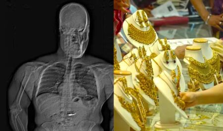 যুক্তরাষ্ট্রে গ্রেফতার এড়াতে ৭ লাখ ডলারের গয়না গিলে ফেলল চোর গয়না গিলে ফেলল চোর