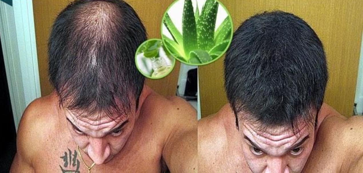 অ্যালোভেরা