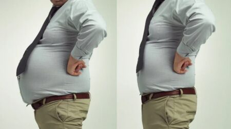 Belly Fat