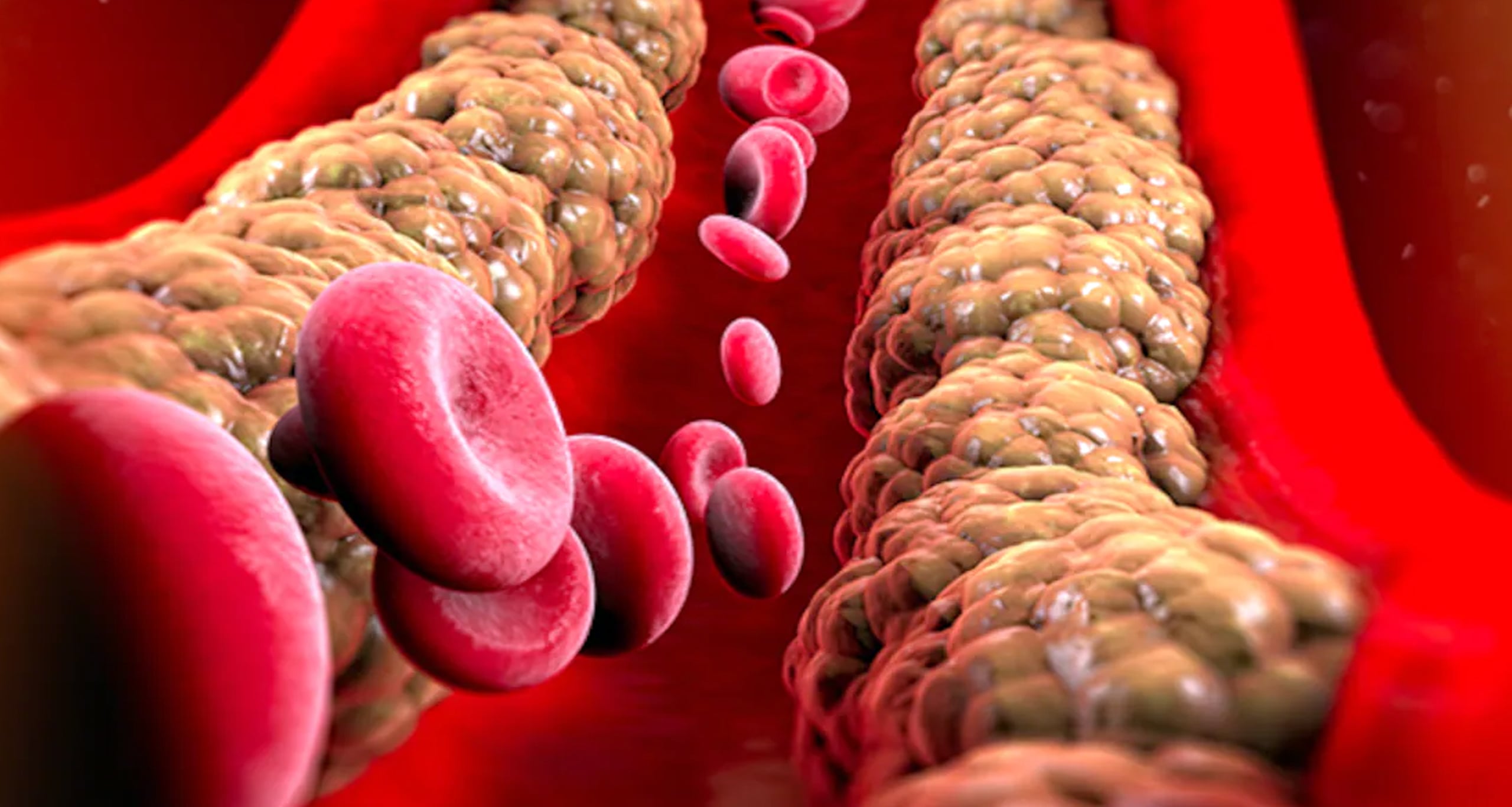 কোলেস্টেরল