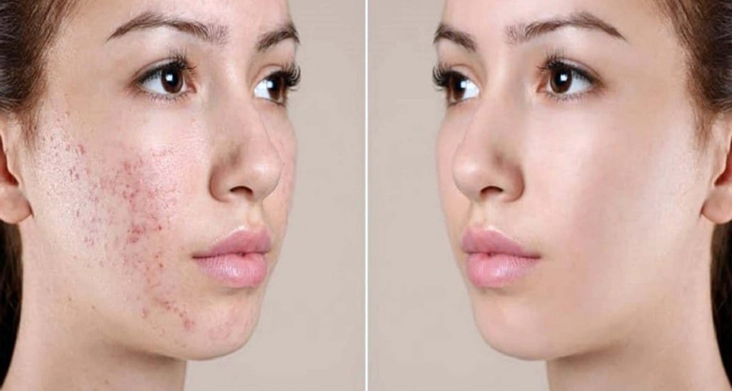 মুখের কালো দাগ