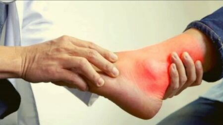 ইউরিক অ্যাসিড