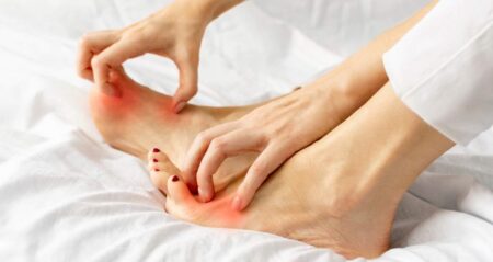 হাত ও পায়ে চুলকানি হলে কী করবেন: কার্যকরী পরামর্শ হাত ও পায়ে চুলকানি হলে কী করবেন