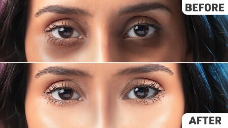 How to Reduce Dark Circles Fast: Proven Overnight Fixes reduce dark circles fast