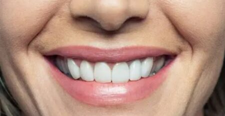 দাঁতের সমস্যা থেকে বাঁচার উপায়