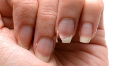 নখ ভাঙ্গা রোধে ঘরোয়া উপায়: সহজ টিপস! নখ ভাঙ্গা