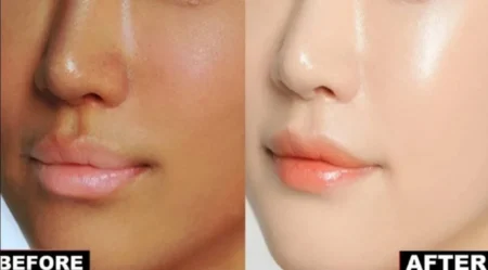 ঘুমানোর আগে এই জিনিসটি মুখে লাগান, মুখ ফুটে উঠবে tok