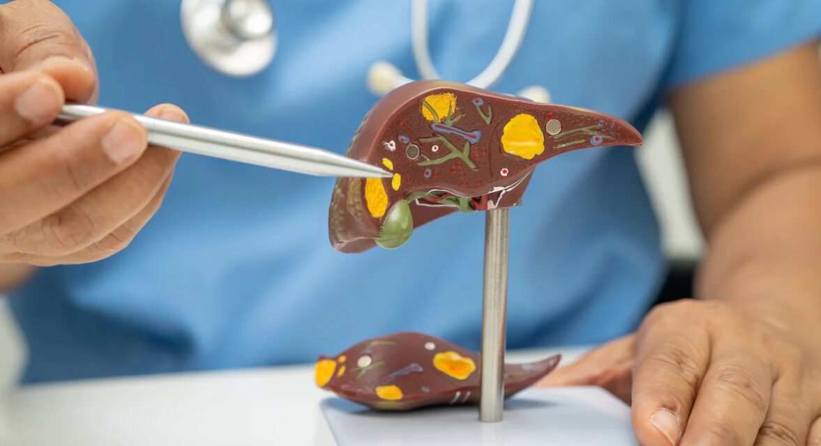 অগ্ন্যাশয় ক্যানসার