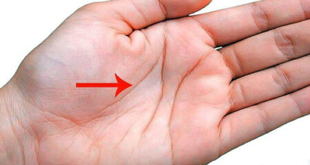 হাতে এম চিহ্ন