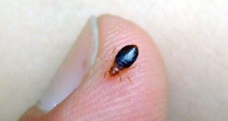 রক্তচোষা ছারপোকা থেকে বাঁচতে যা করবেন ছারপোকা