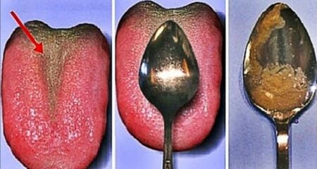 ফুসফুস বা কিডনি