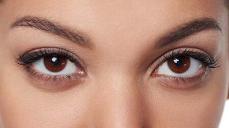 চোখের স্ট্রোক