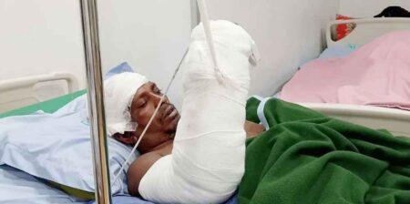 বিচ্ছিন্ন হাত