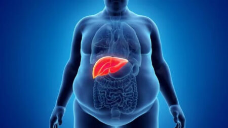 ফ্যাটি লিভার থেকে বাঁচতে যে ৩ পানীয় এড়িয়ে চলবেন faty liver