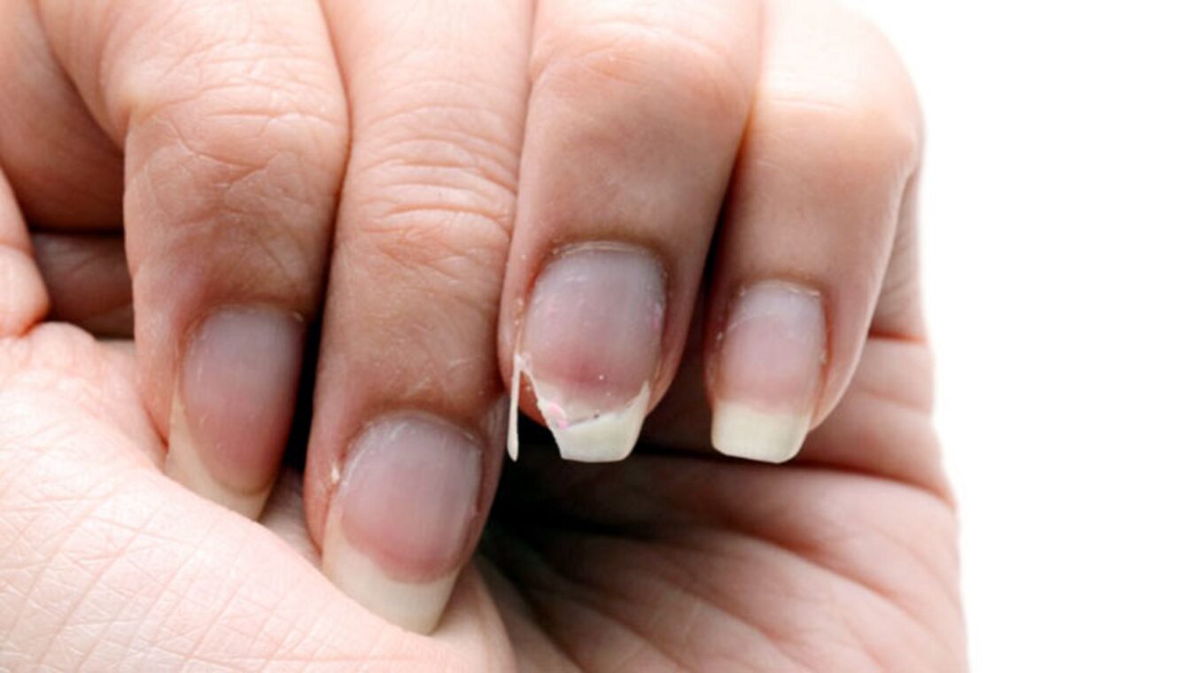 ক্যালসিয়ামের ঘাটতি মেটাতে