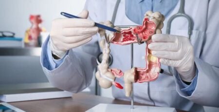 কোলন ক্যানসার