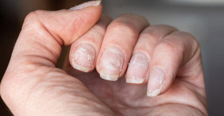 বিক্রি হচ্ছে আঙুলের কাটা নখ