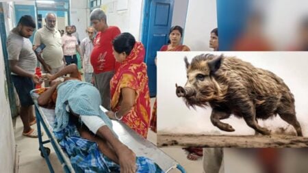 শূকরের কামড়ে আহত
