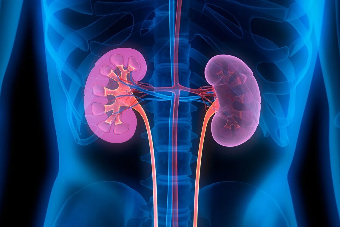 Chronic-kidney-disease