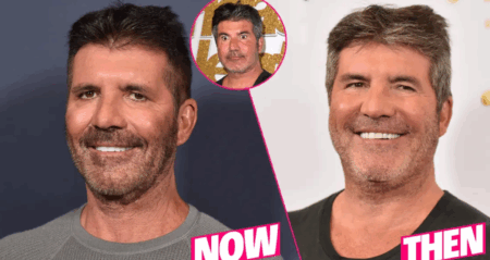 Simon Cowell’s Inner Circle Urges Him to Halt Cosmetic Procedures Simon Cowell plastic surgery