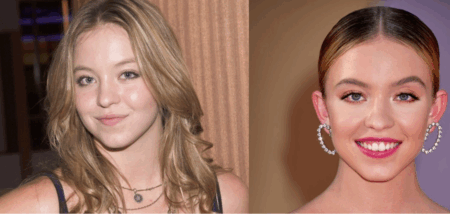 Sydney Sweeney Denies Plastic Surgery Rumors, Vows to Age Naturally Sydney Sweeney plastic surgery