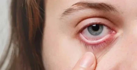 স্ট্রোকের লক্ষণ ফুটে