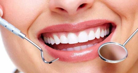 দাঁতের পাথর দূর