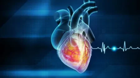 Heart Attack