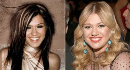 Kelly Clarkson Reveals Manager Pressured Her for Cosmetic Surgery Kelly Clarkson plastic surgery
