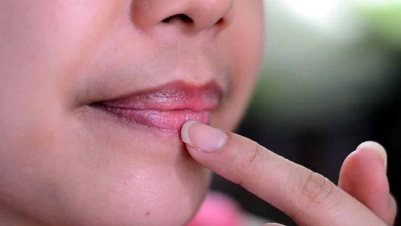 ঠোঁটের কালচে দাগ