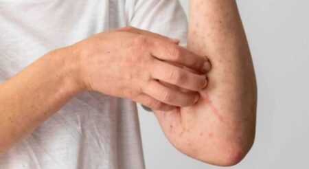 শীতে শরীর চুলকায় কেন, জানুন কারণ ও প্রতিকার শীতে শরীর চুলকায়