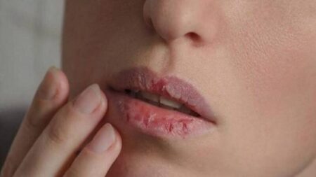 শীতে যেন ঠোঁট না ফাটে: সহজ ৫টি যত্নের উপায় ঠোঁট না ফাটে