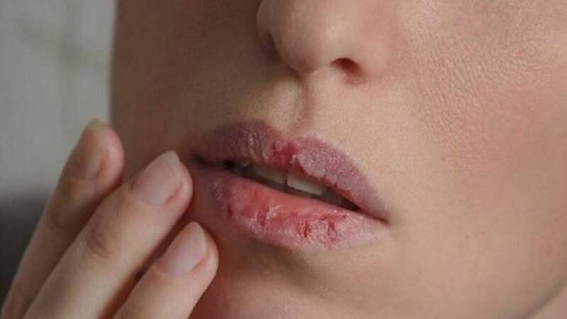 ঠোঁট না ফাটে