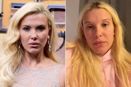 Millie Bobby Brown Confronts Plastic Surgery Rumors and Online Bullying plastic surgery rumors