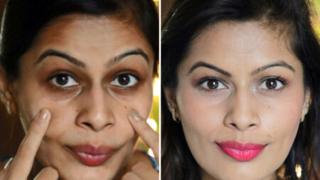 মুখের কালো দাগ