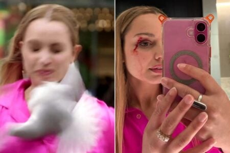 Reporter Struck by Seagull During Live TV Shoot, Incident Caught on Camera reporter hit by bird