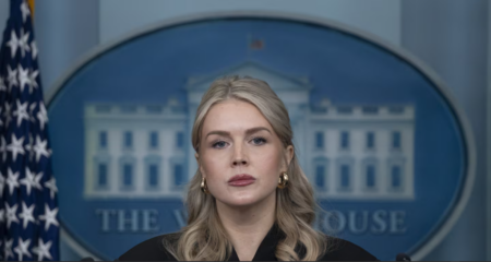 Karoline Leavitt lip filler