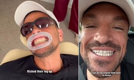 Peter Andre's Stage Injury Sparks Celebrity Dental Emergency Trend Alert