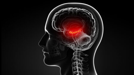 ব্রেন ডেথ