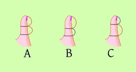 আঙুলের আকৃতি