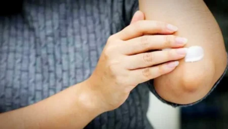 কনুইয়ের কালচে দাগ