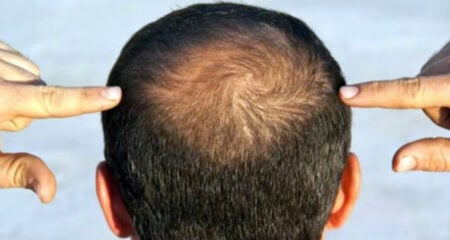 মানুষের চুল