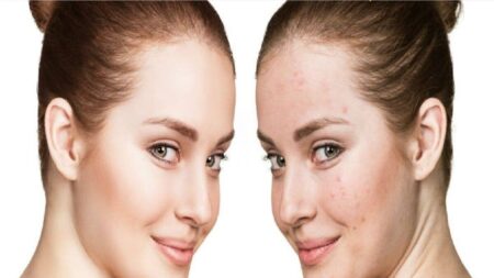 ভিটামিনের অভাবে বয়স